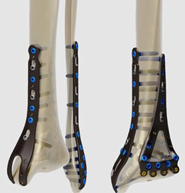 Kemik sağlığının ‘yazılımına’ imza attılar