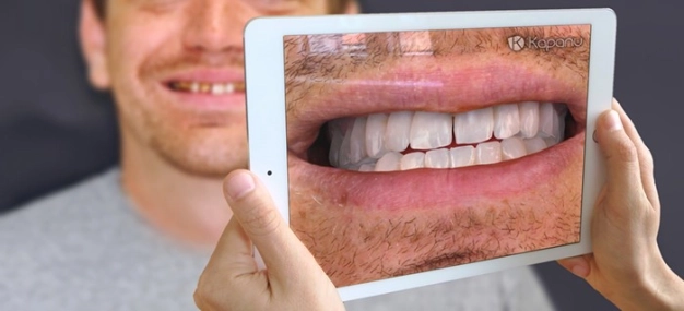 Alerjen maddeyi 10 dakikada tespit edin