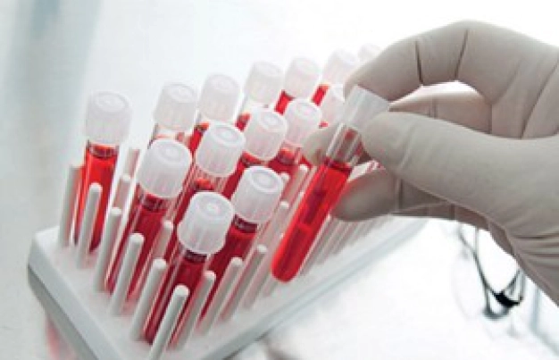 Ses dalgaları erken kanser alarmı verecek