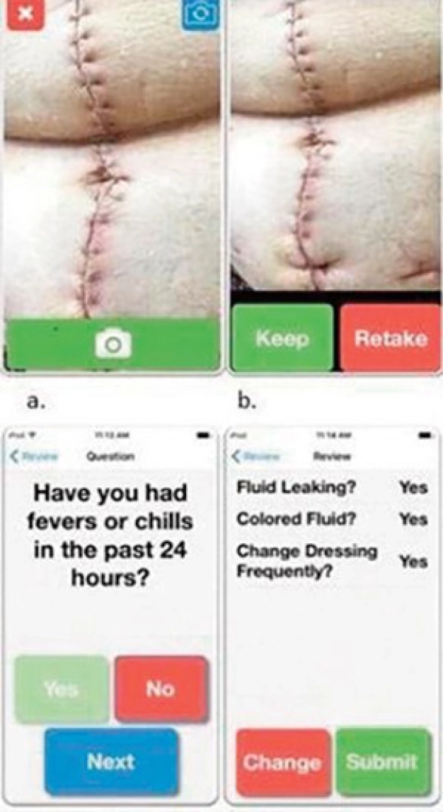 ‘Cep’ten ameliyat sonrası enfeksiyon takibi