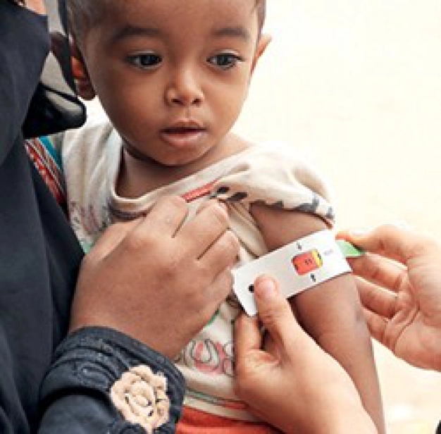 Yemen’de dört beslenme sağlığı merkezi açtılar