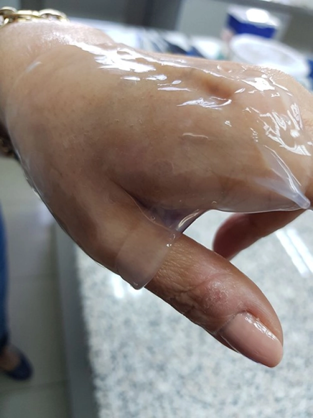 Küresel salgına karşı YERLİ BİYOBARİYER