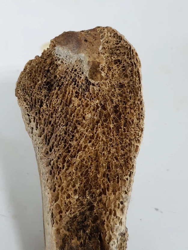 Ar-Ge ile yapay kadavra