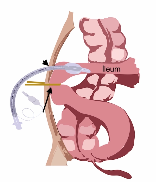 Def-i haceti yönetme cihazı